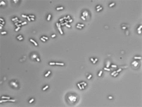 Lactobacillus Colony Morphology