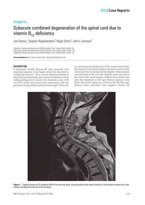 (PDF) Subacute combined degeneration of the spinal cord due to vitamin ...