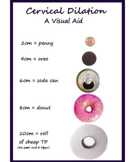 Labor. | Cervical dilation chart, Cervix dilation, Dilations