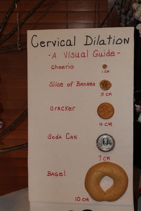 Cervical Dilation Chart....WOW! | Graduation!! | Pinterest | Nursing ...