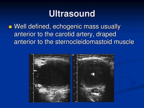 PPT - Branchial Cleft Cyst PowerPoint Presentation - ID:261469