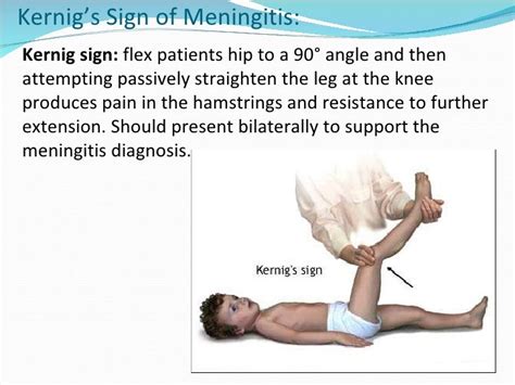 Short presentation version cns infections Lecture