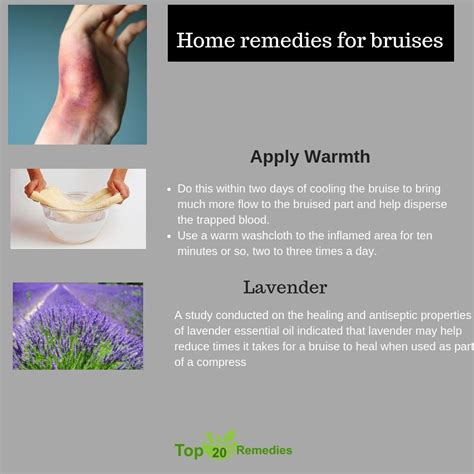 Home remedies for bruises | Home remedies for bruises, Bruises remedy, Home remedies