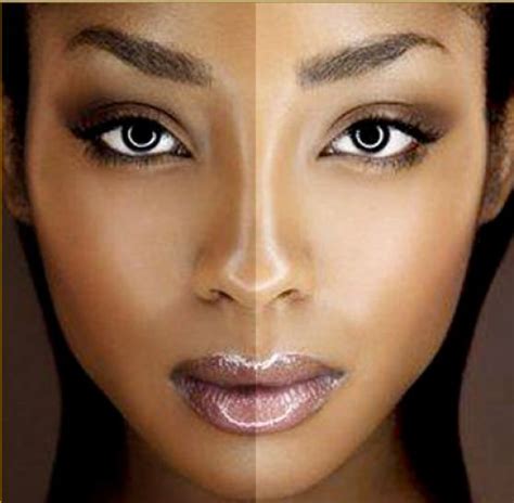 Beauty Tips & Personal Health Care: More About Skin Discolorations And ...