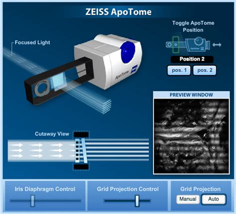 Live-Cell Imaging: Choosing the Right Technique