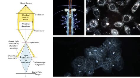 Dark Field Microscopy - Principle, Parts, Procedure, Uses - Biology Notes Online