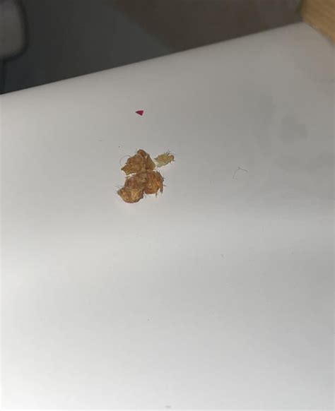 Huge ball of wax fell out of my ear : r/earwax