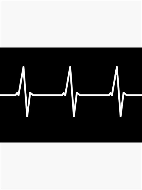 "Electrocardiogram (ECG) Heart Beat (White)" Sticker for Sale by STUDIO-72 | Redbubble