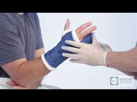 How to apply an ULNAR GUTTER (Boxer) Cast - Plus Cast Removal - YouTube