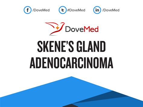 Skene’s Gland Adenocarcinoma