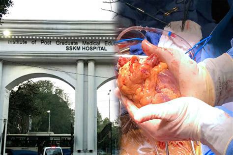 Looking back Today SSKM Hospital created history with first heart transplant