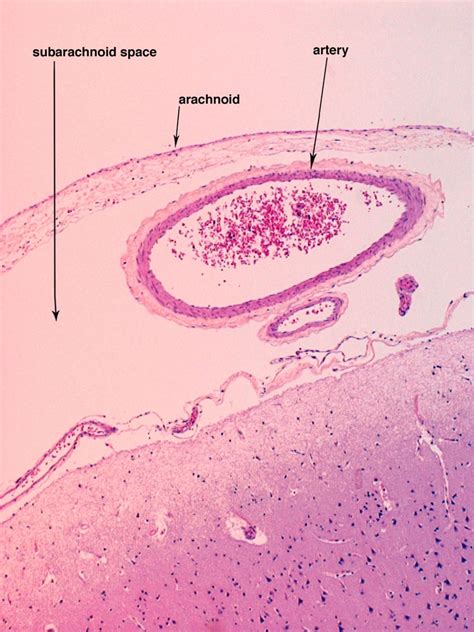 Arachnoid Mater Histology