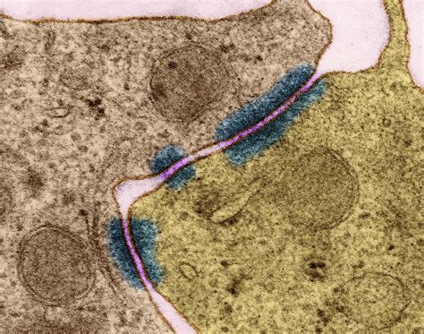 Epithelial Cell Zonula Adherens Photograph by Dennis Kunkel Microscopy/science Photo Library ...