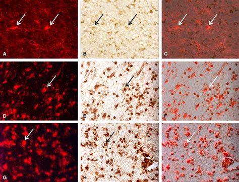 Double-labeling studies for cell specific markers (red fluorescent ...