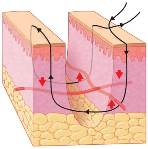 Mattress | Suture.app