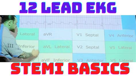 12 Lead EKG STEMI Basics: Inferior, Septal, Anterior, Lateral MI with Coronary Anatomy - YouTube