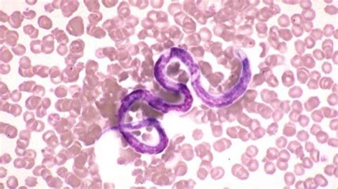 Heartworm Microfilaria