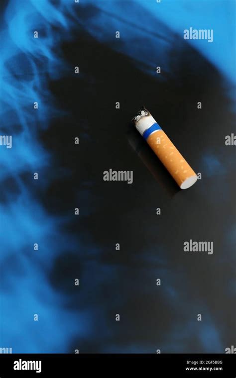 Cigarette on x-ray lung, close up Stock Photo - Alamy