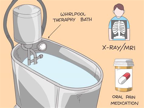 Easy Ways to Treat an Ice Burn: 12 Steps (with Pictures) - wikiHow