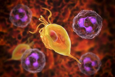 CE Activity | Trichomoniasis | Nurses