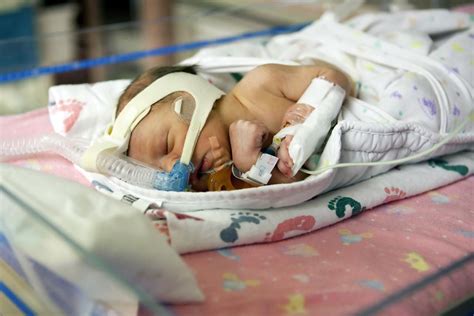 Bradycardia and Apnea in Premature Babies