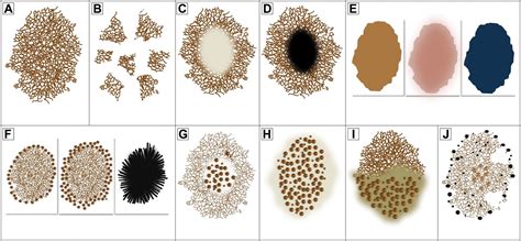 Dermoscopy: A Review of the Structures That Facilitate Melanoma Detection