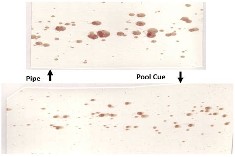 Arterial Spray Blood Spatter