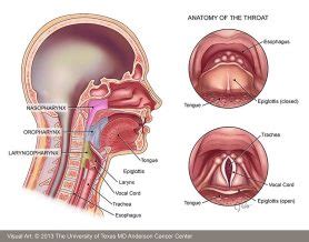 Early Throat Cancer Treatment