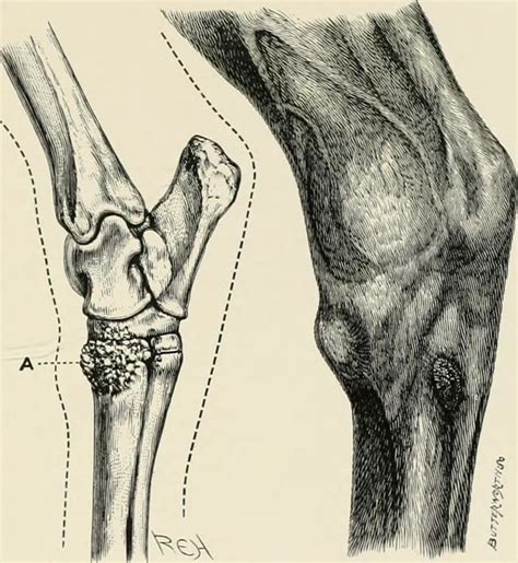 Bone spavin - Alchetron, The Free Social Encyclopedia