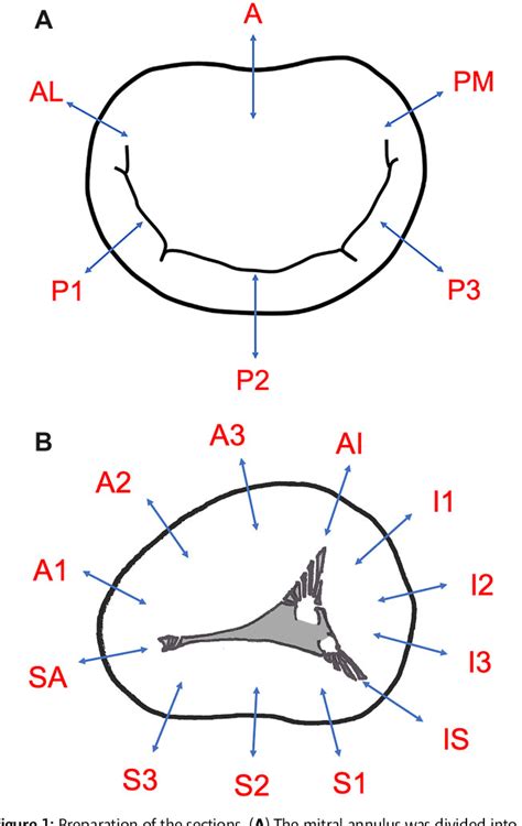 [PDF] Histology of the tricuspid valve annulus and right ...