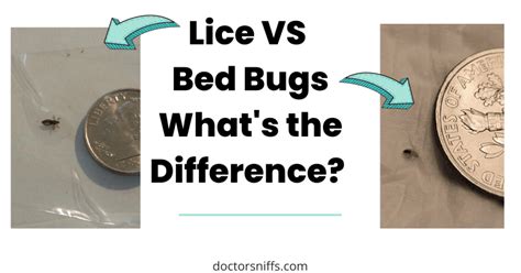 Lice vs Bed Bugs - Ultimate Guide with Photos