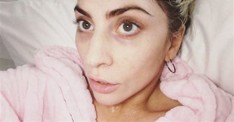 Lady Gaga Rocks the No-Makeup Look — What She's Said About Going Bare