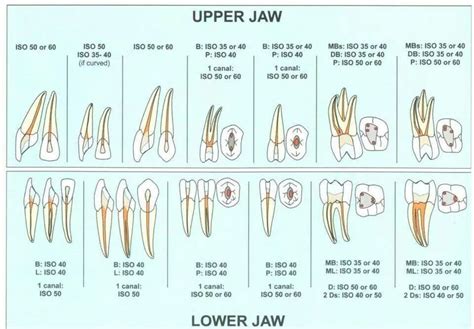 Endo access | Restorative dentistry, Dentistry, Dental