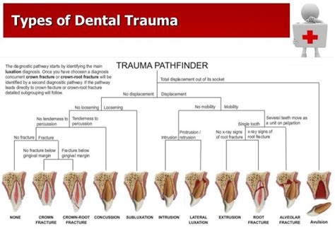 trauma by Dr.Chandan G.D