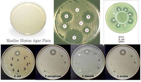 Mueller Hinton Agar (MHA) – Composition, Principle, Uses and Preparation | Microbiology, Agar ...