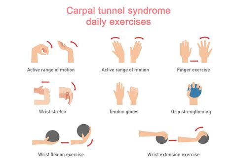 How Carpal Tunnel Affects People's Quality of Life – SAPNA Pain ...