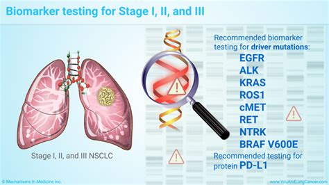 Slide Show - Targeted Therapy in Non-Small Cell Lung Cancer