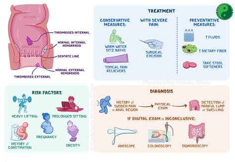 Treatment for Hemorrhoids - Philadelphia Homeopathic Clinic