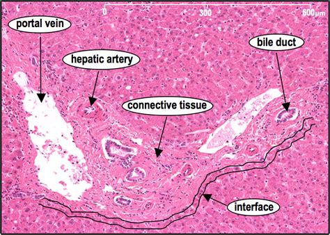 Histology Slides Bile Duct Triad Arteries Liver Portal Diagram The | Sexiz Pix