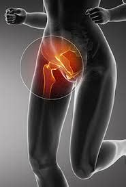 Chronic Groin Pain – More Than Just Osteitis Pubis - Newcastle Sports Medicine