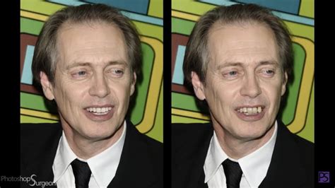 Steve Buscemi Teeth Fixed