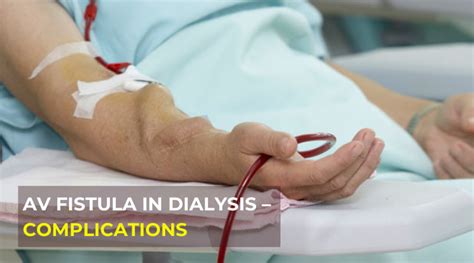 Arteriovenous Fistula Access for Dialysis Mumbai, India | Dr. Jathin's Vein Center