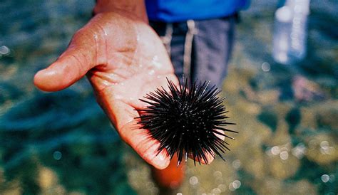 Sea Urchin Sting Removal