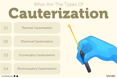 Cauterization: Causes, Symptoms, Treatment and Cost