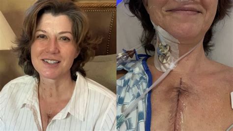 Amy Grant Shares Photos After Undergoing Open Heart Surgery