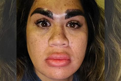 The procedure goes wrong and leaves the woman with creepy eyebrows