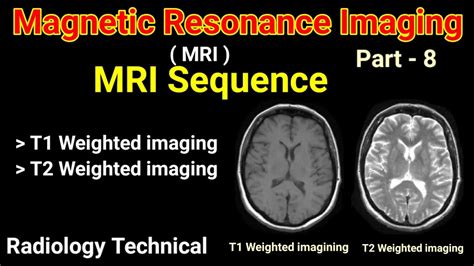 MRI # Part - 8 # MRI Sequences # T1 Weighted Imaging & T2 Weighted Imaging # || By BL Kumawat ...