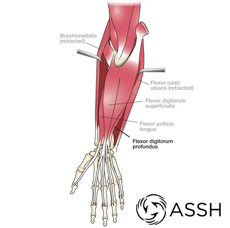 Body Anatomy: Upper Extremity Tendons | The Hand Society