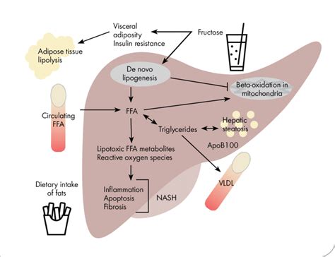 FIGURE . This diagram illustrates nonalcoholic fatty liver disease ...