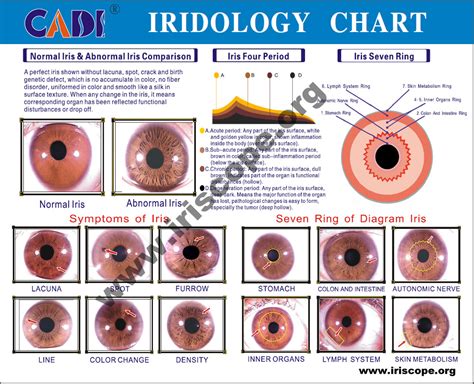 eye reflexology chart 10 pcs free downlaod | iriscope | iridology camera | iriscope camera ...